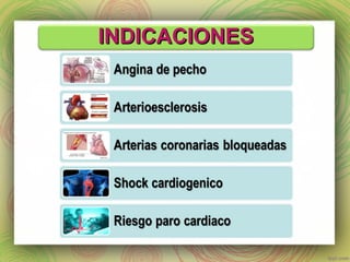IINNDDIICCAACCIIOONNEESS 
 