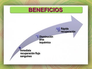 BBEENNEEFFIICCIIOOSS 
 