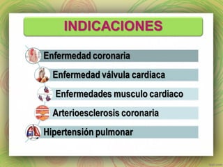 Cateterismo cardiaco y Angioplastia