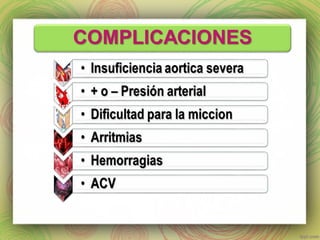 Cateterismo cardiaco y Angioplastia
