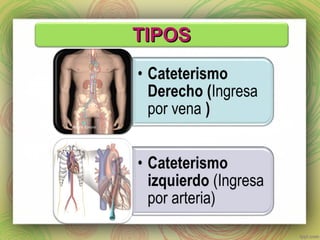TTIIPPOOSS 
 