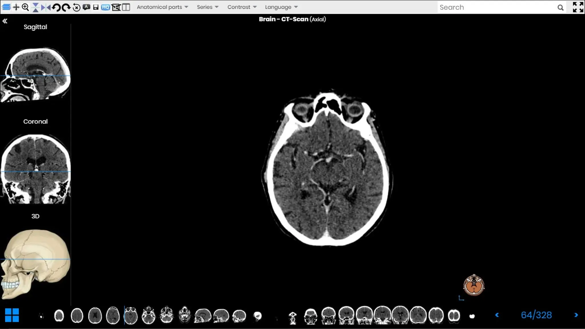 Revision for brain cross-sectional anatomy | PPTX