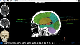 Revision for brain cross-sectional anatomy | PPTX