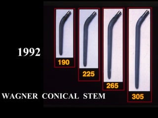 1992

WAGNER CONICAL STEM

 