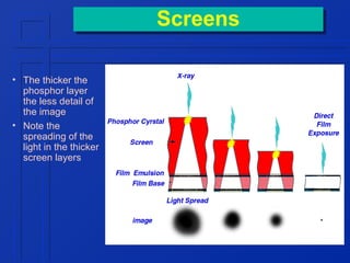 Screens
Screens
• The thicker the
phosphor layer
the less detail of
the image
• Note the
spreading of the
light in the thicker
screen layers

 