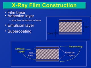 X-Ray Film Construction
X-Ray Film Construction
• Film base
• Adhesive layer
– attaches emulsion to base

• Emulsion layer
• Supercoating

Adhesive
Layers

”007.
”0005.

Supercoating
Film
Base

Emulsion
Layers

 