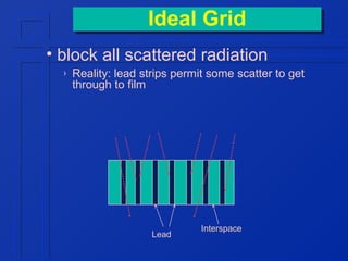 Ideal Grid
Ideal Grid
• block all scattered radiation
›

Reality: lead strips permit some scatter to get
through to film

Lead

Interspace

 