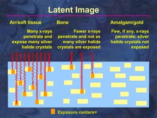 Latent Image
Air/soft tissue
Many x-rays
penetrate and
expose many silver
halide crystals

Bone

Amalgam/gold

Fewer x-rays
penetrate and not as
many silver halide
crystals are exposed

Few, if any, x-rays
penetrate; silver
halide crystals not
exposed

Exposure centers=

 
