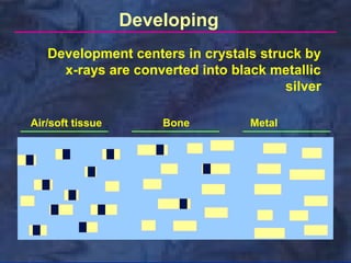 Developing
Development centers in crystals struck by
x-rays are converted into black metallic
silver
Air/soft tissue

Bone

Metal

 