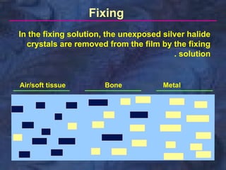 Fixing
In the fixing solution, the unexposed silver halide
crystals are removed from the film by the fixing
. solution

Air/soft tissue

Bone

Metal

 