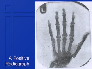 A Positive
Radiograph

 