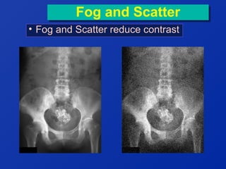 Fog and Scatter
Fog and Scatter
• Fog and Scatter reduce contrast

 