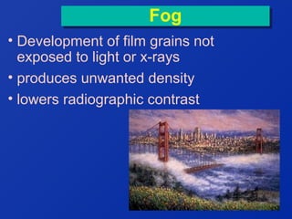 Fog
Fog
• Development of film grains not
exposed to light or x-rays
• produces unwanted density
• lowers radiographic contrast

 