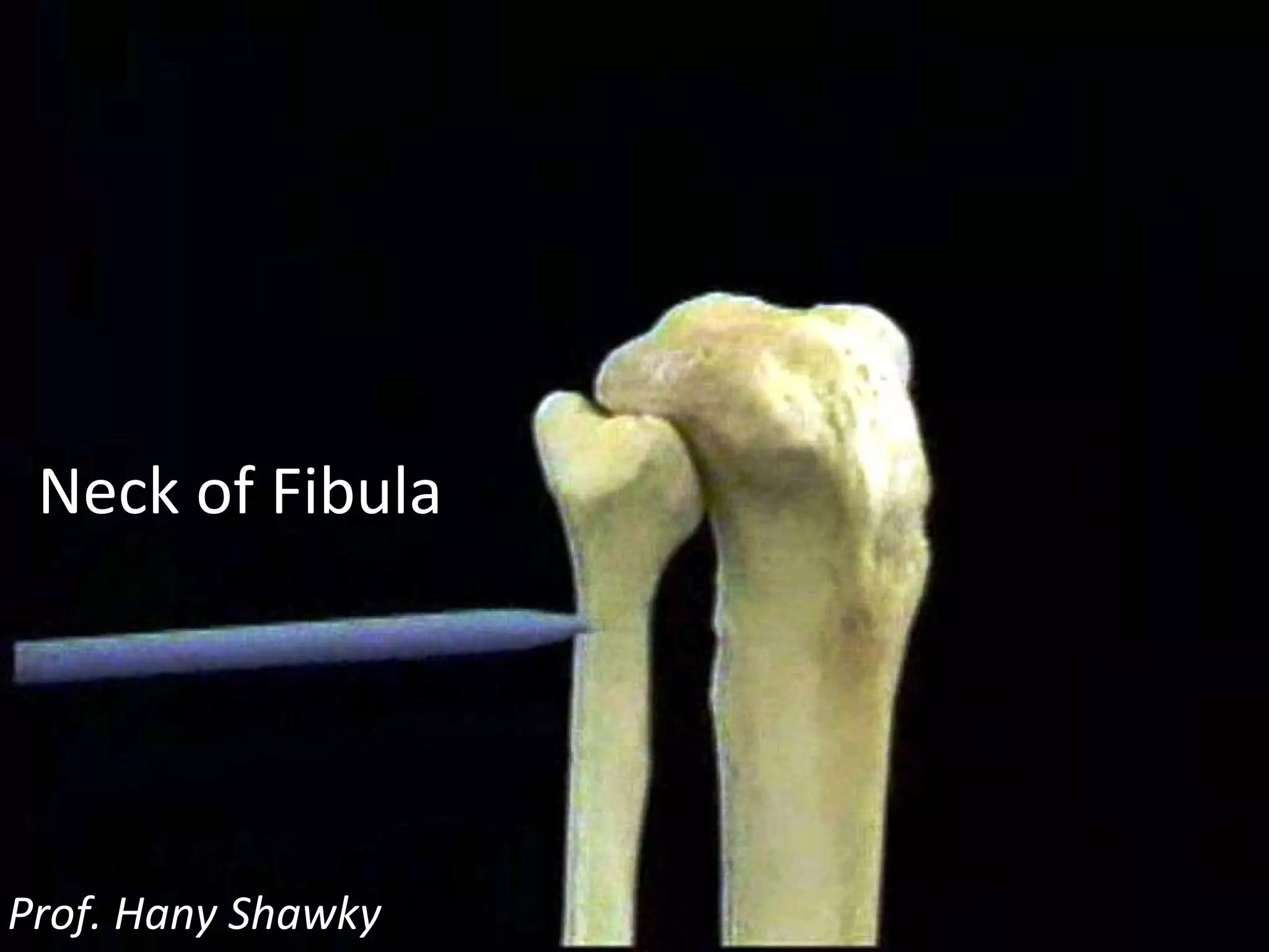 Neck of Fibula Prof. Hany Shawky