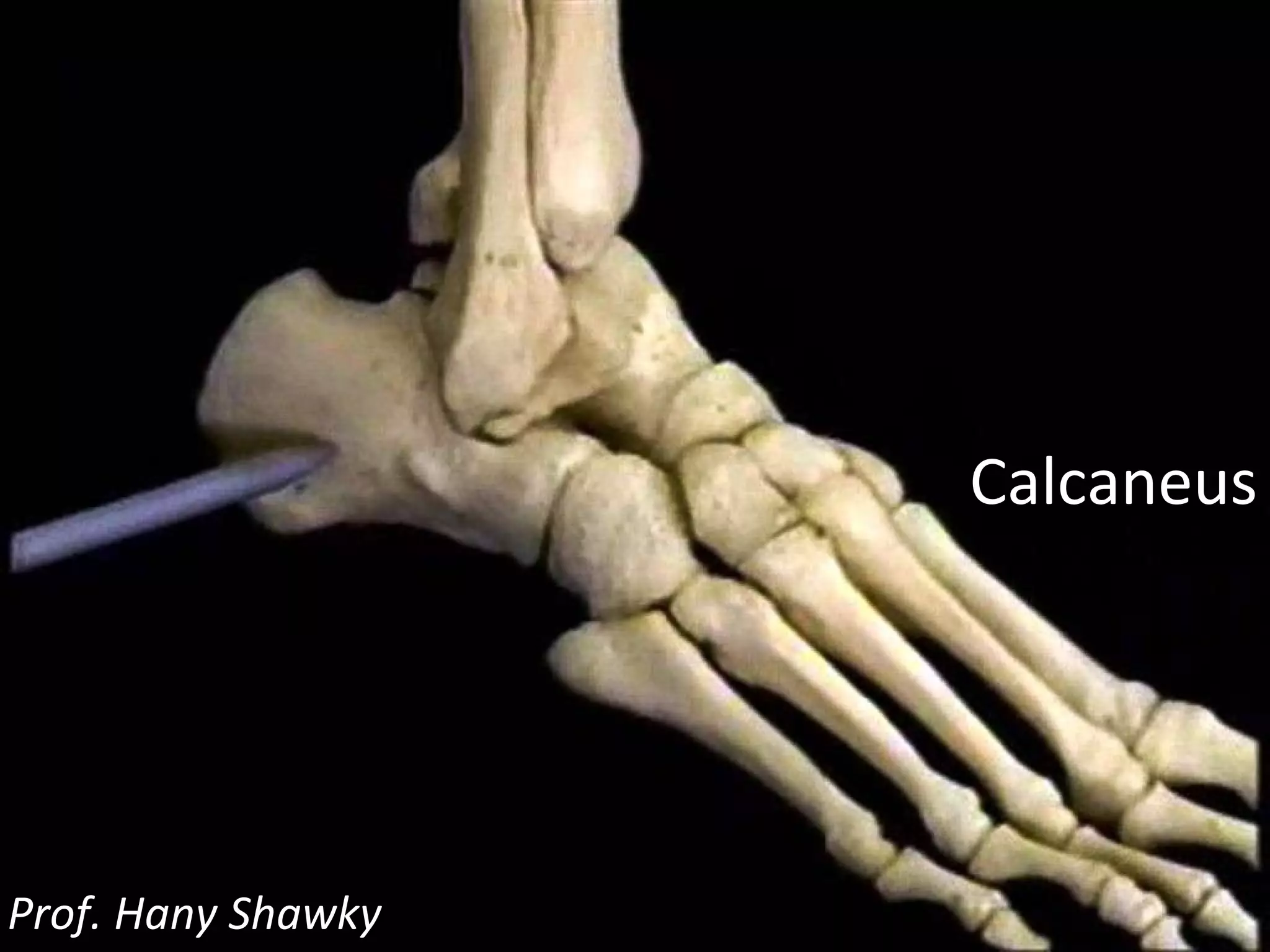 Calcaneus Prof. Hany Shawky