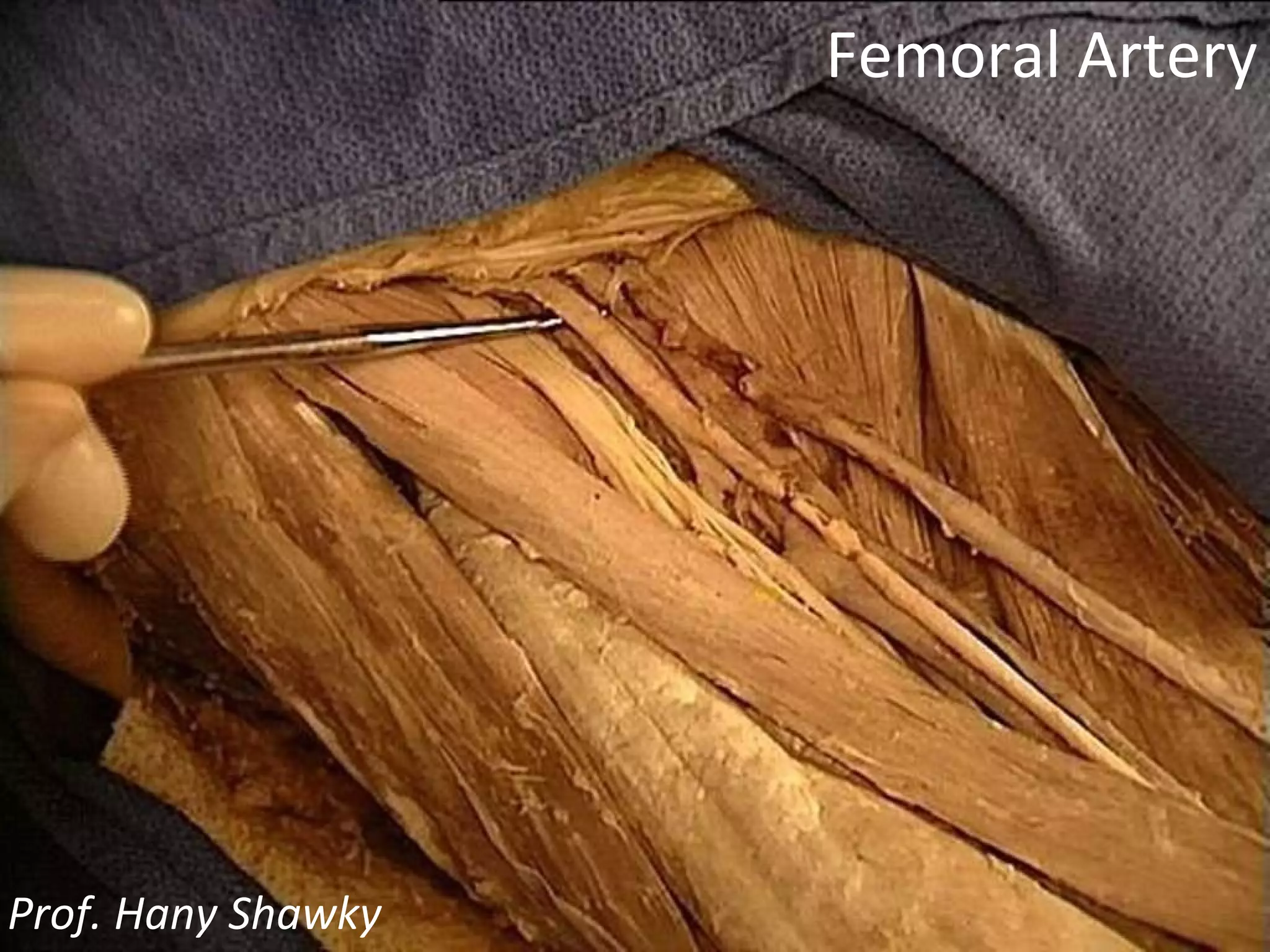 Femoral Artery Prof. Hany Shawky