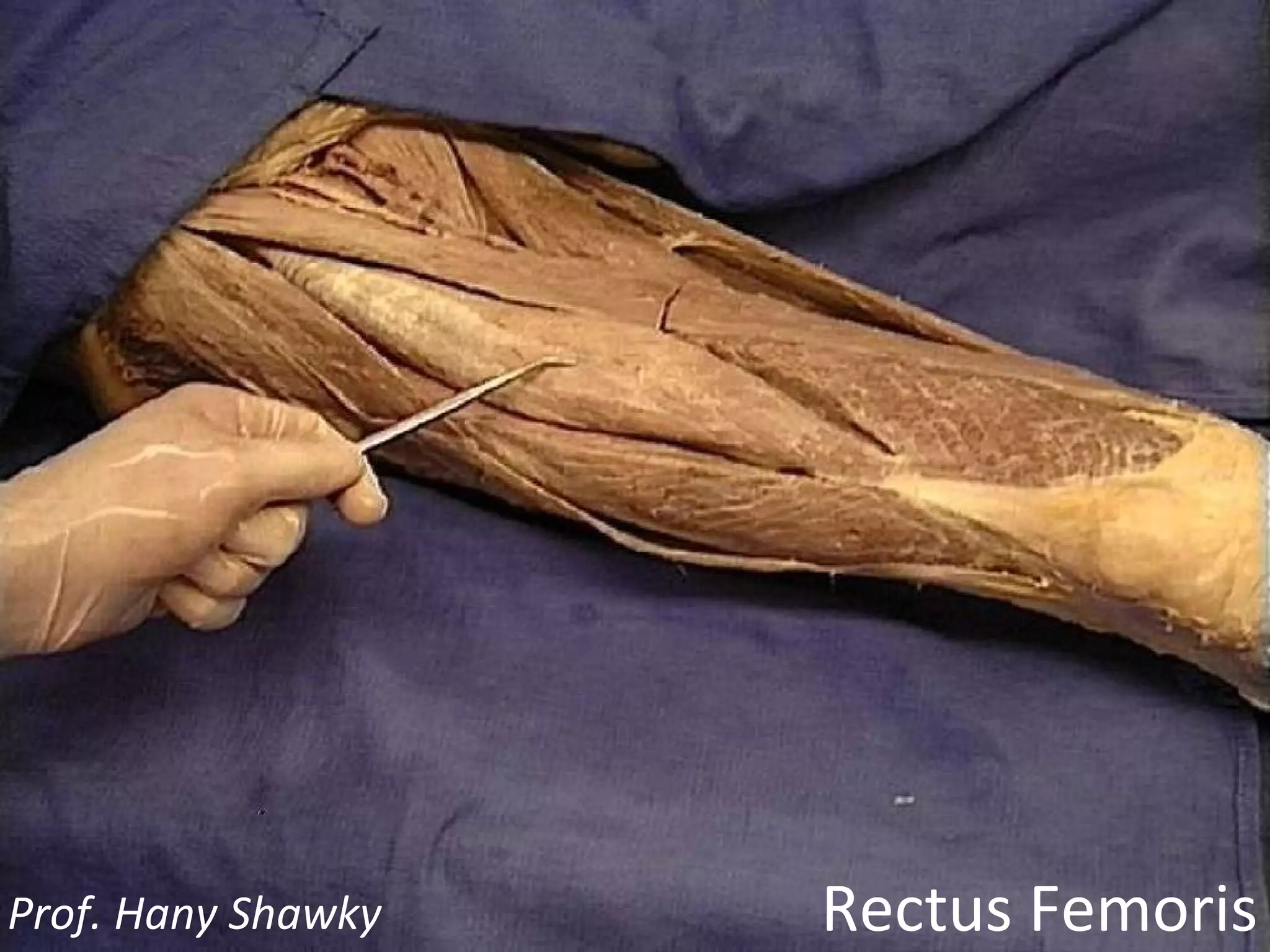 Rectus Femoris Prof. Hany Shawky