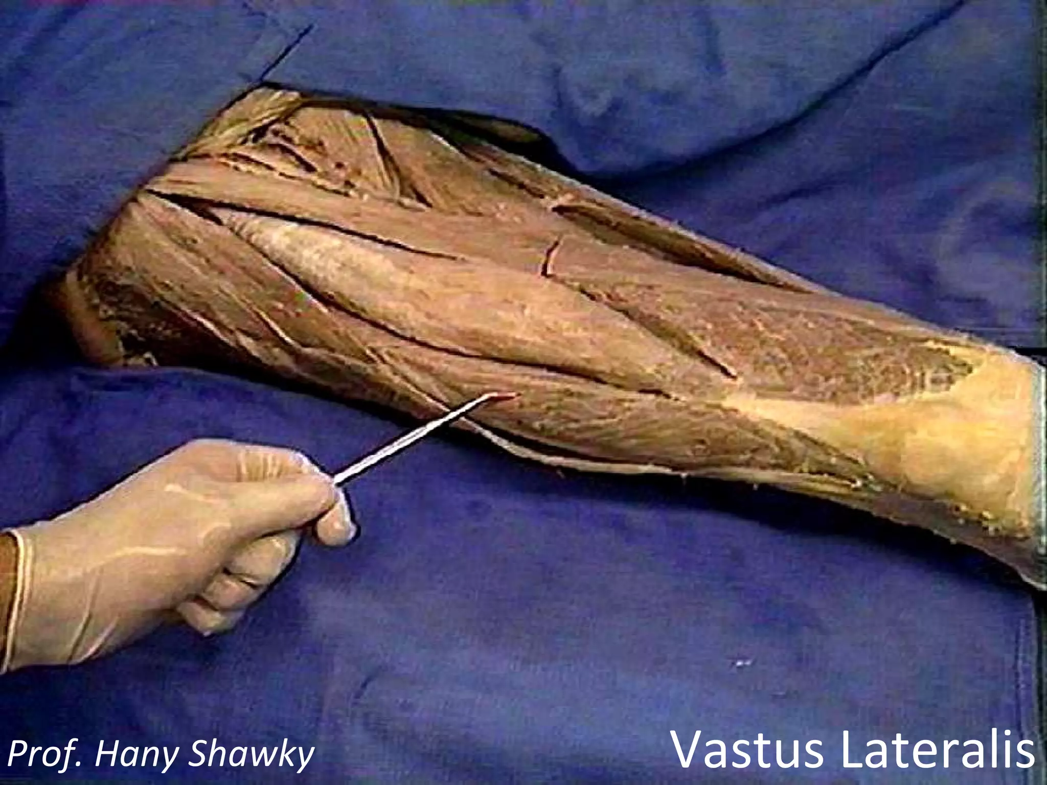Vastus Lateralis Prof. Hany Shawky