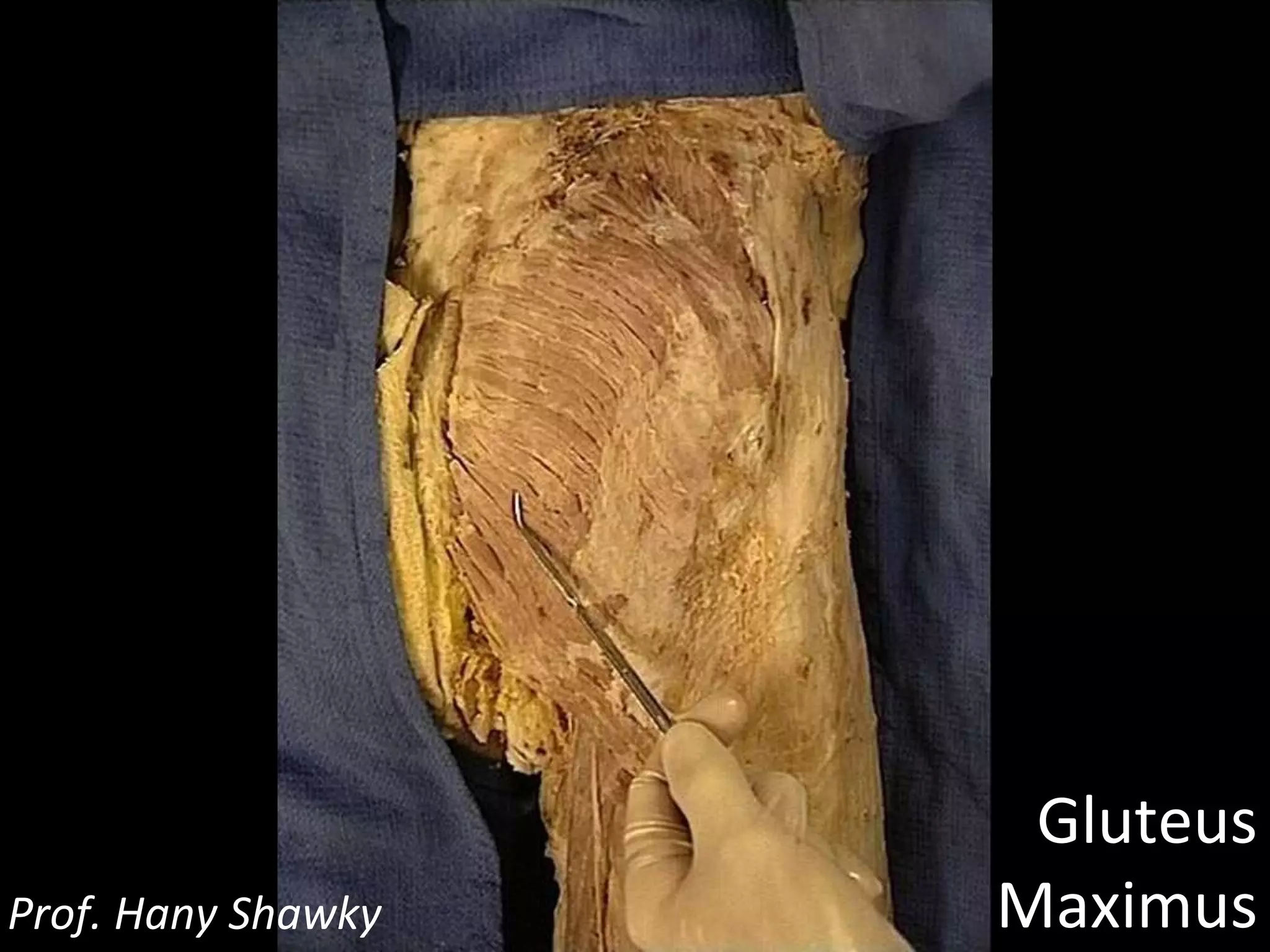 Gluteus Maximus Prof. Hany Shawky