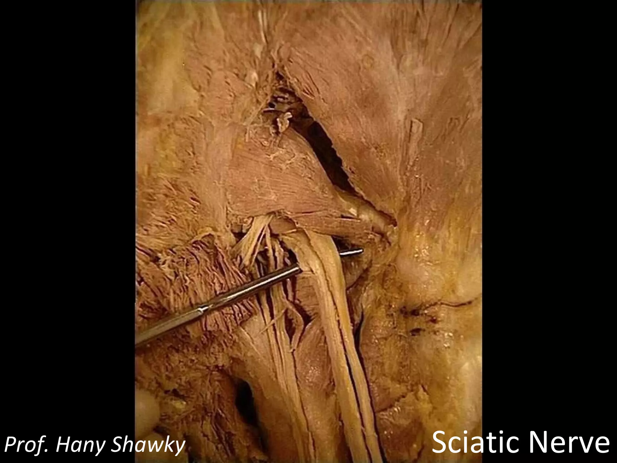Sciatic Nerve Prof. Hany Shawky