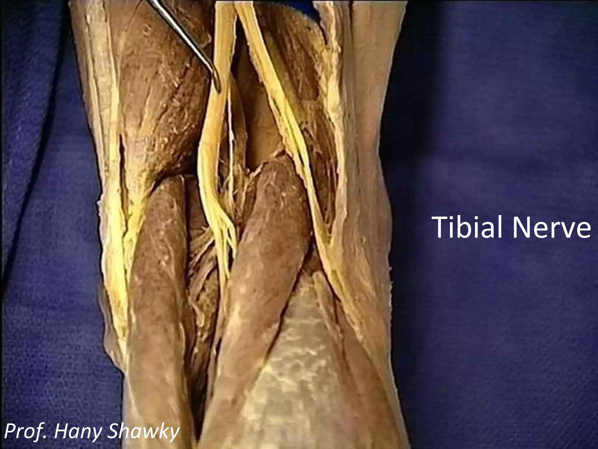 Tibial Nerve Prof. Hany Shawky