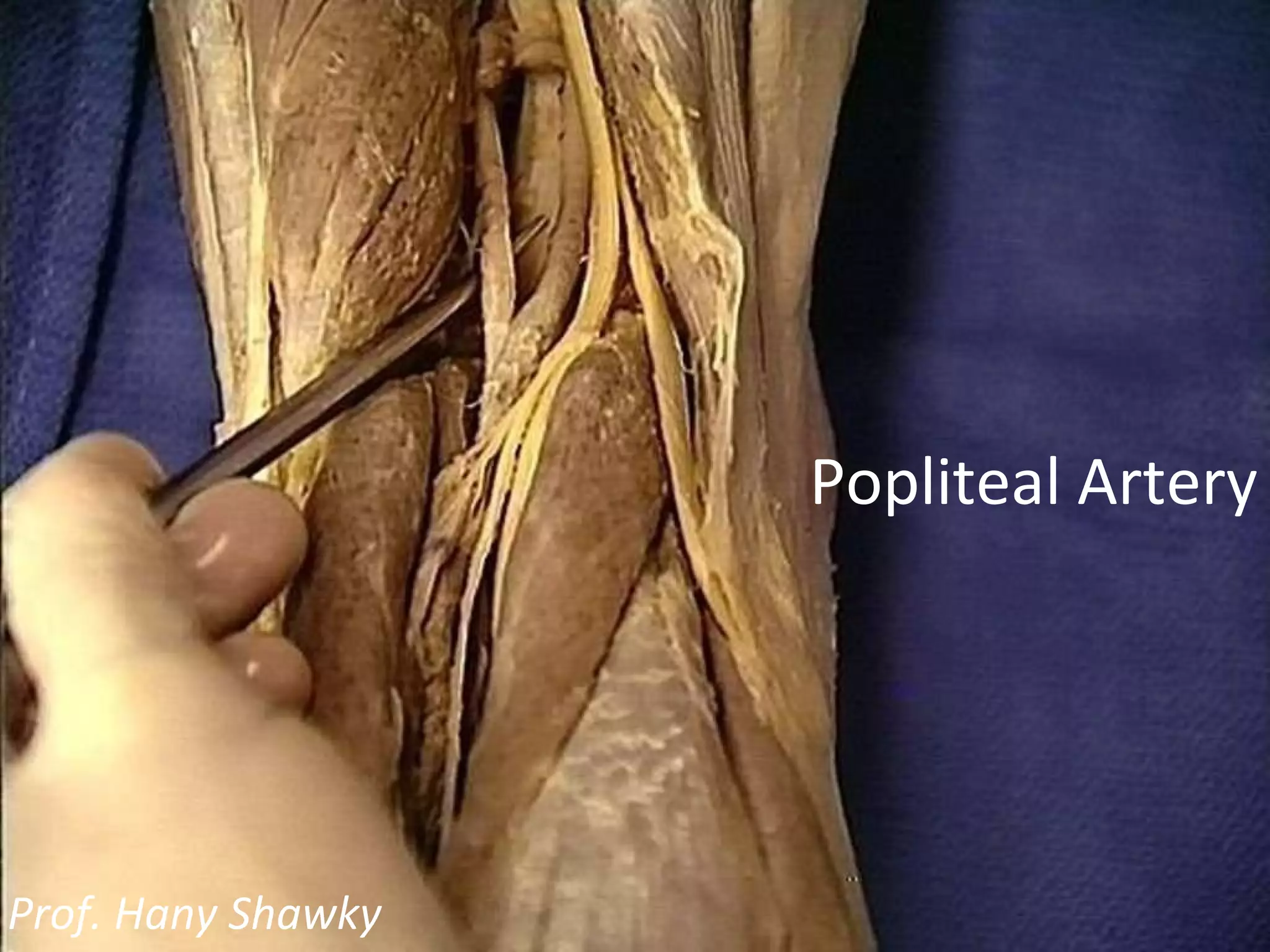 Popliteal Artery Prof. Hany Shawky