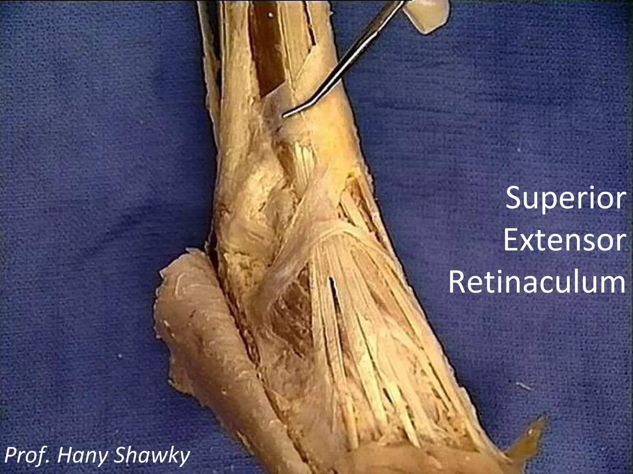 Prof. Hany Shawky Superior Extensor Retinaculum