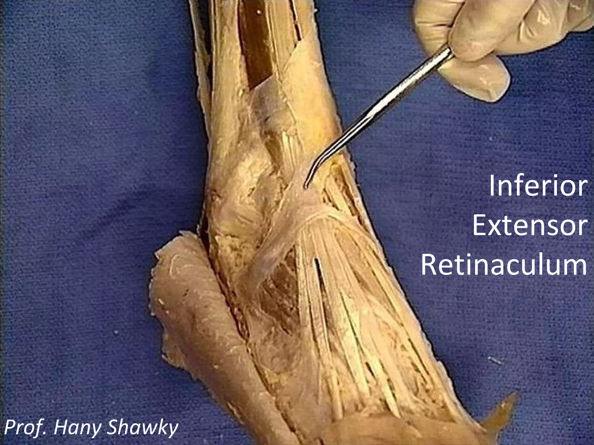 Inferior Extensor Retinaculum Prof. Hany Shawky