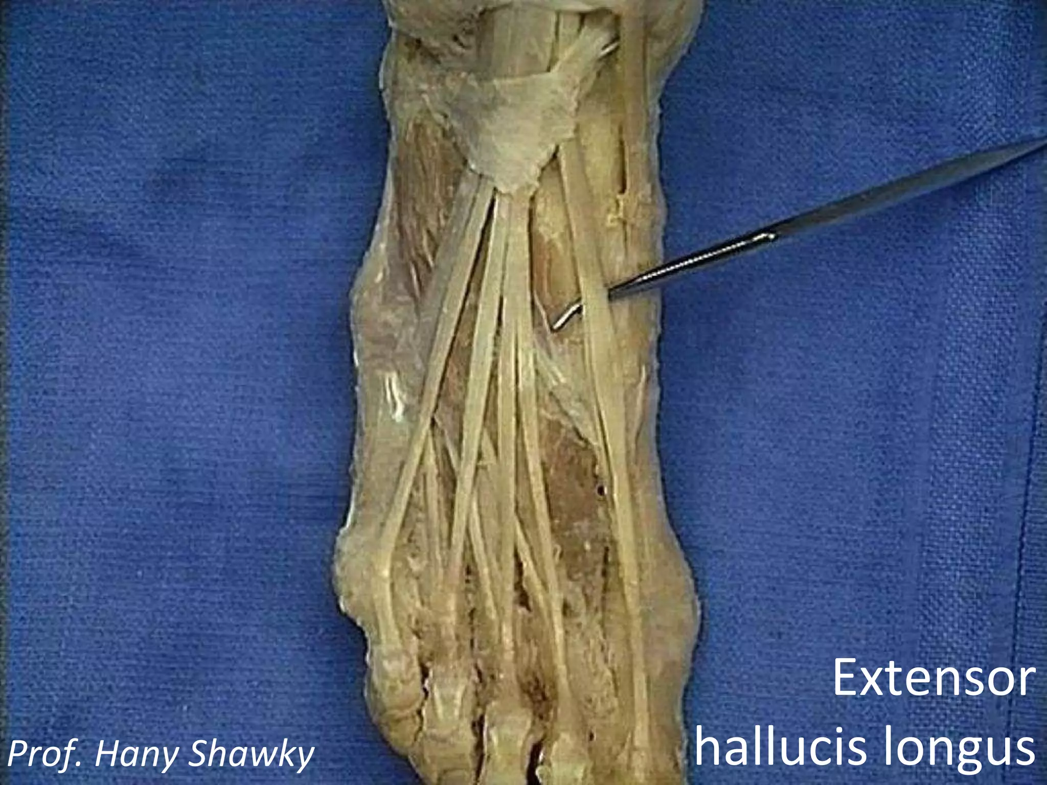 Extensor hallucis longus Prof. Hany Shawky