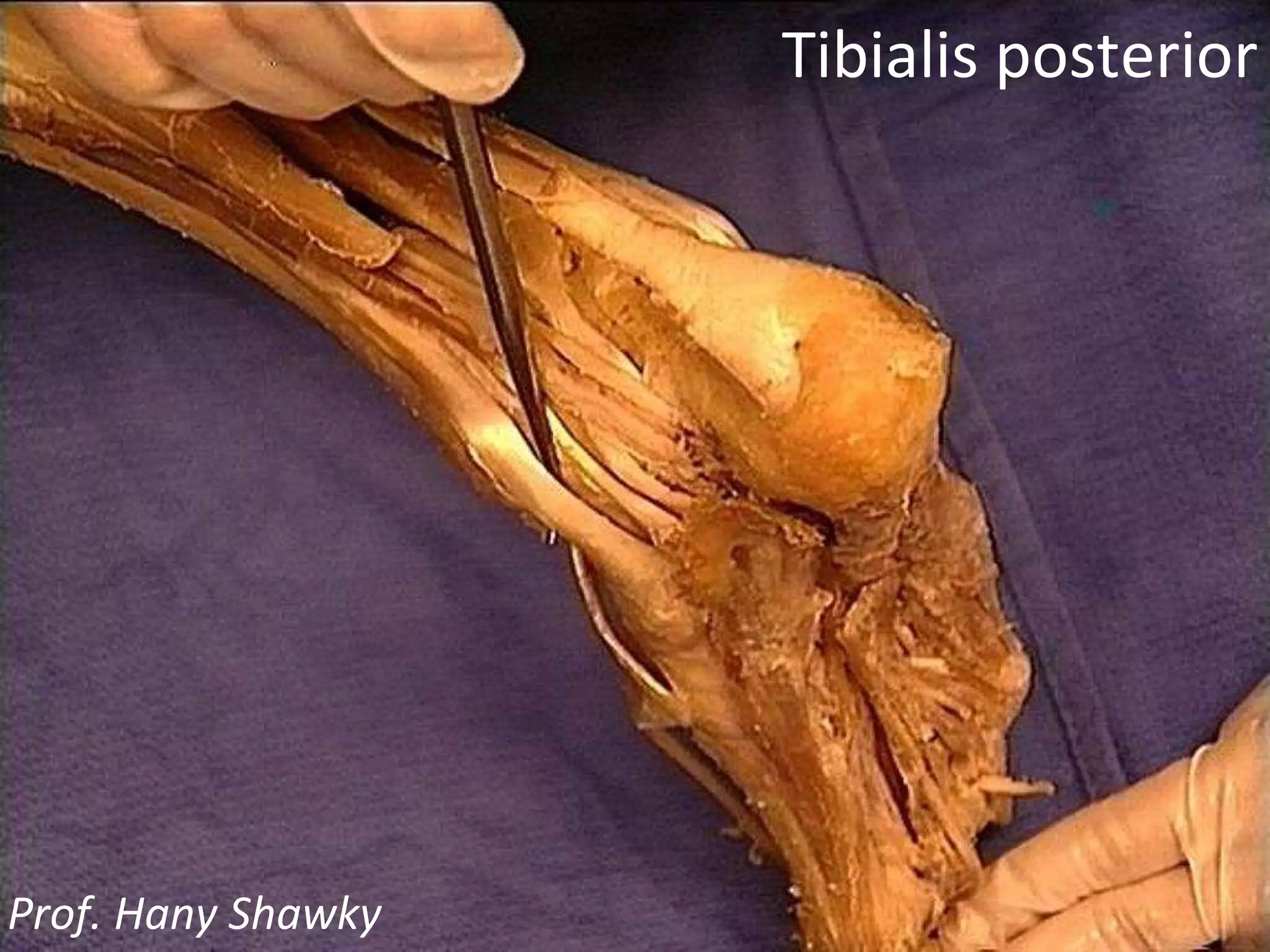 Tibialis posterior Prof. Hany Shawky