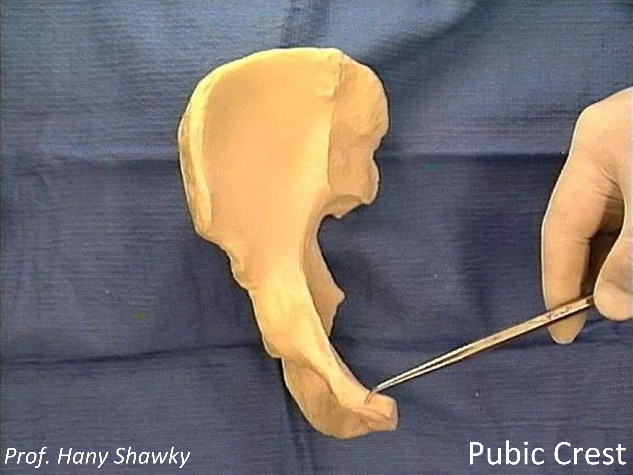 Pubic Crest Prof. Hany Shawky
