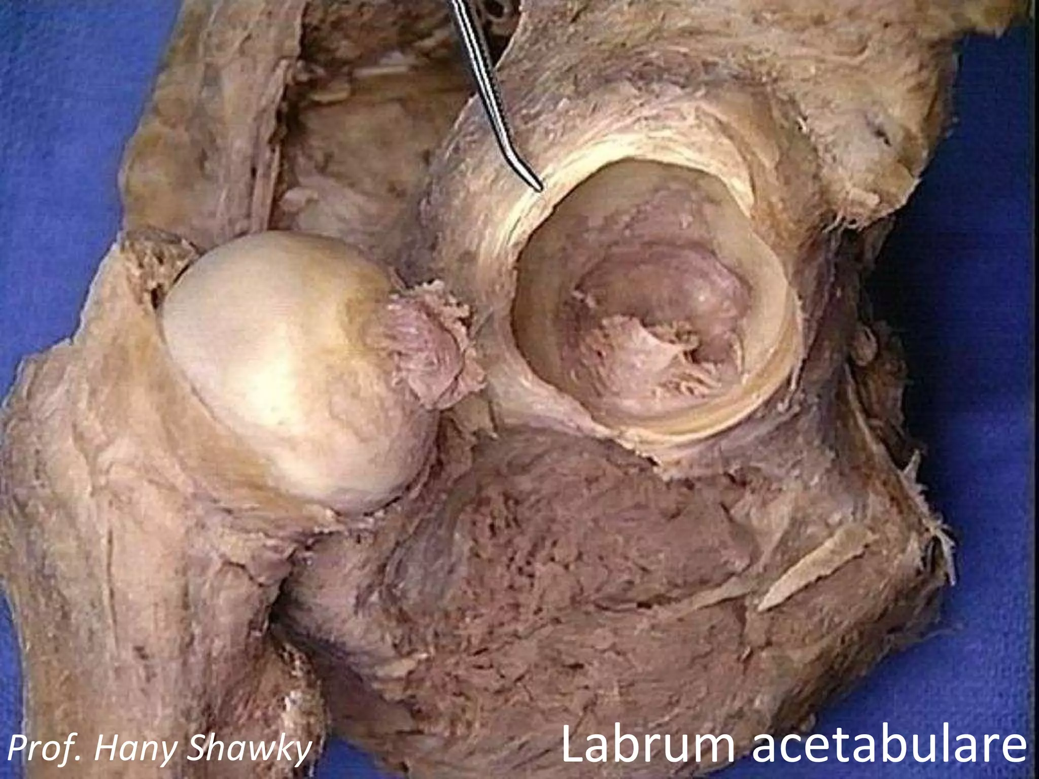 Labrum acetabulare Prof. Hany Shawky