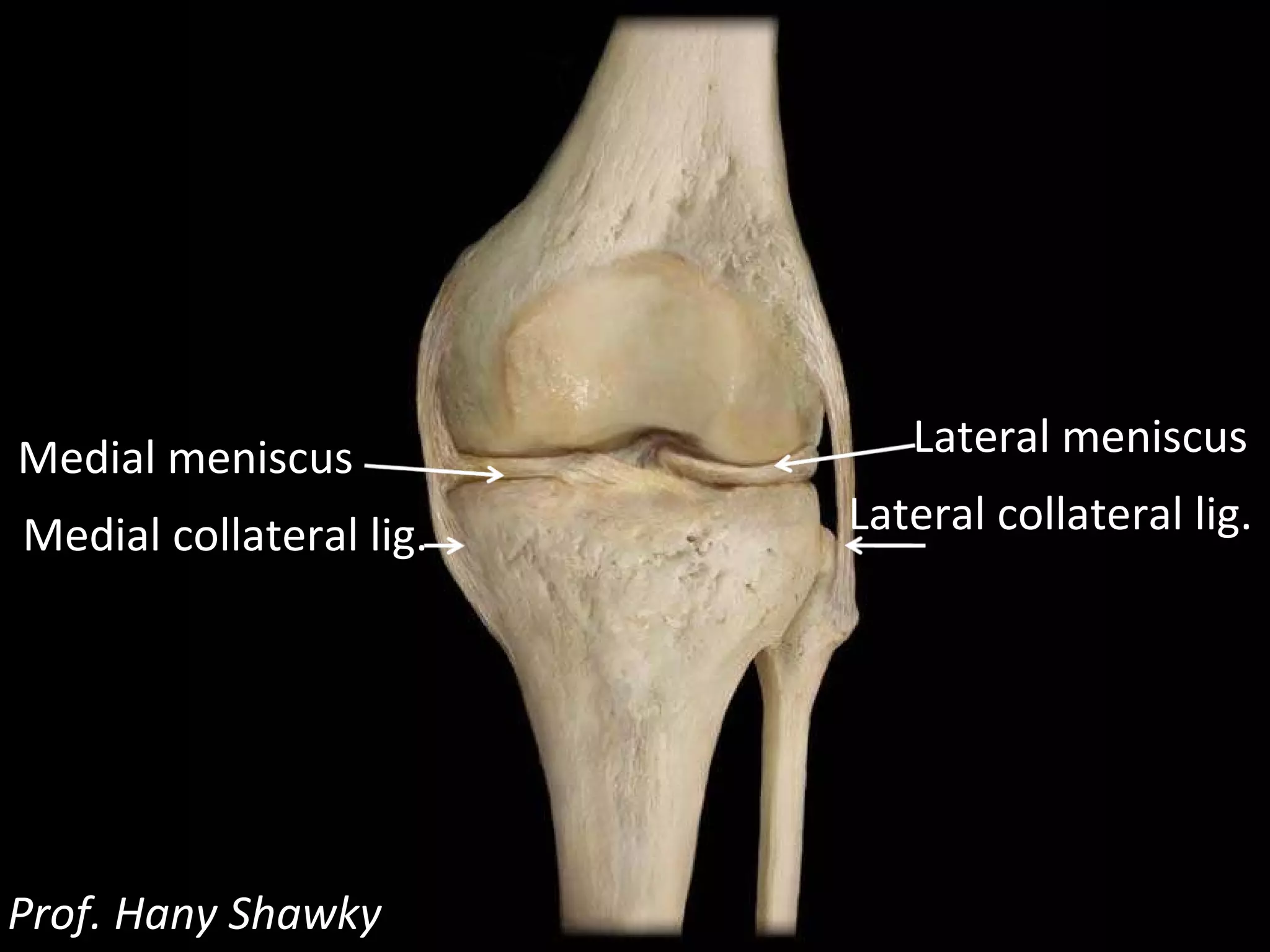Prof. Hany Shawky Lateral collateral lig. Lateral meniscus Medial collateral lig. Medial meniscus
