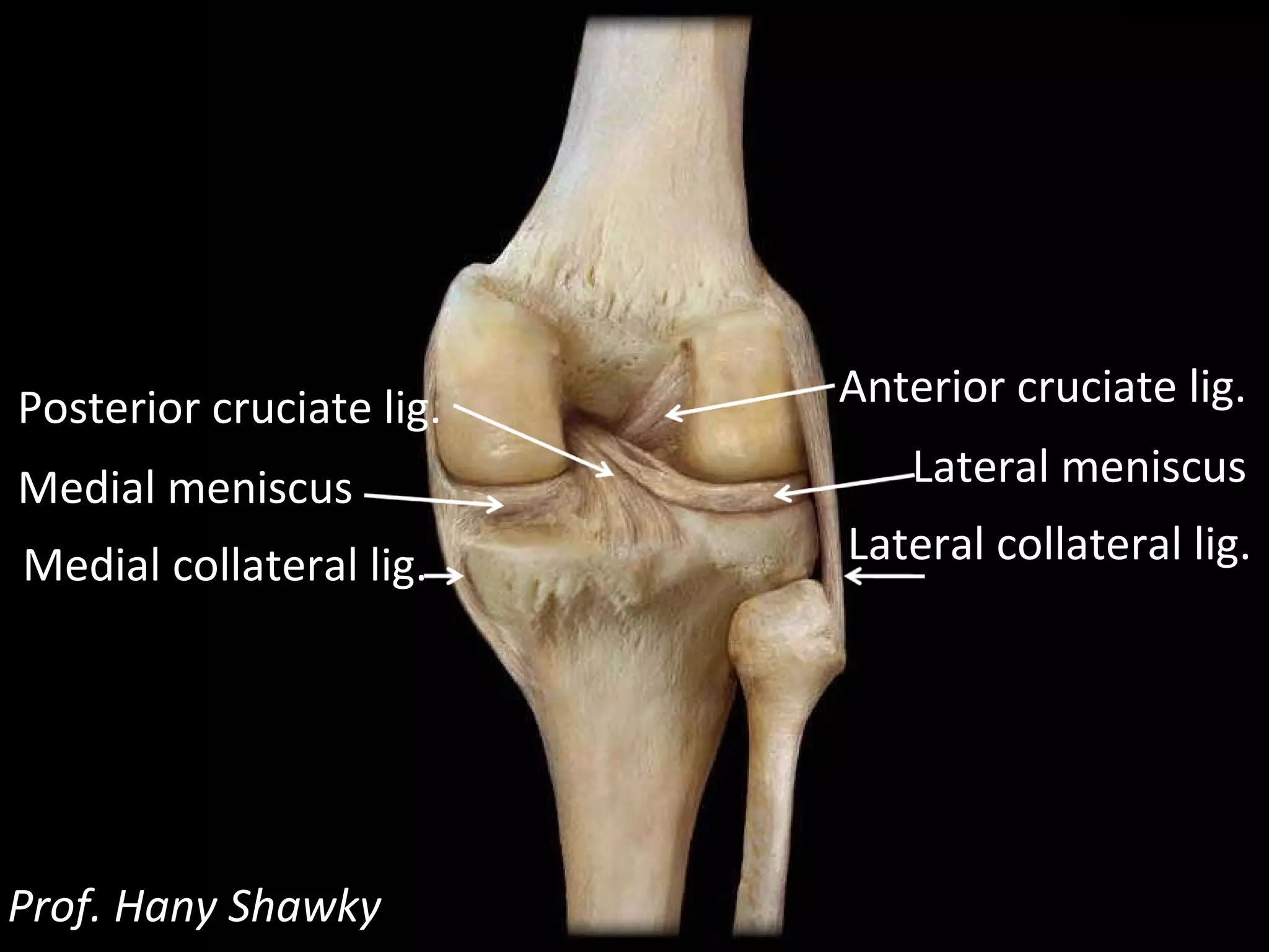Lateral collateral lig. Prof. Hany Shawky Anterior cruciate lig. Lateral meniscus Medial collateral lig. Posterior cruciate lig. Medial meniscus