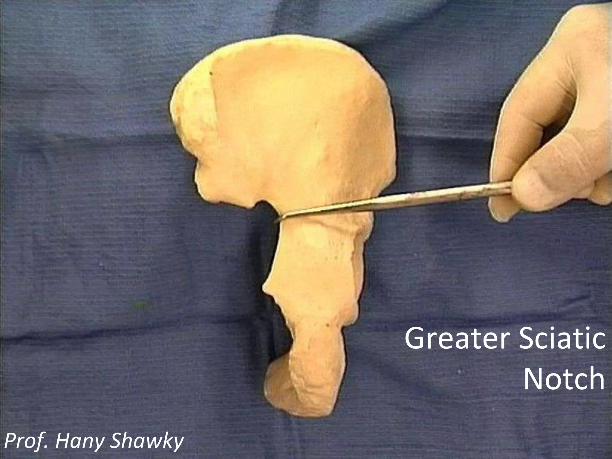 Greater Sciatic Notch Prof. Hany Shawky