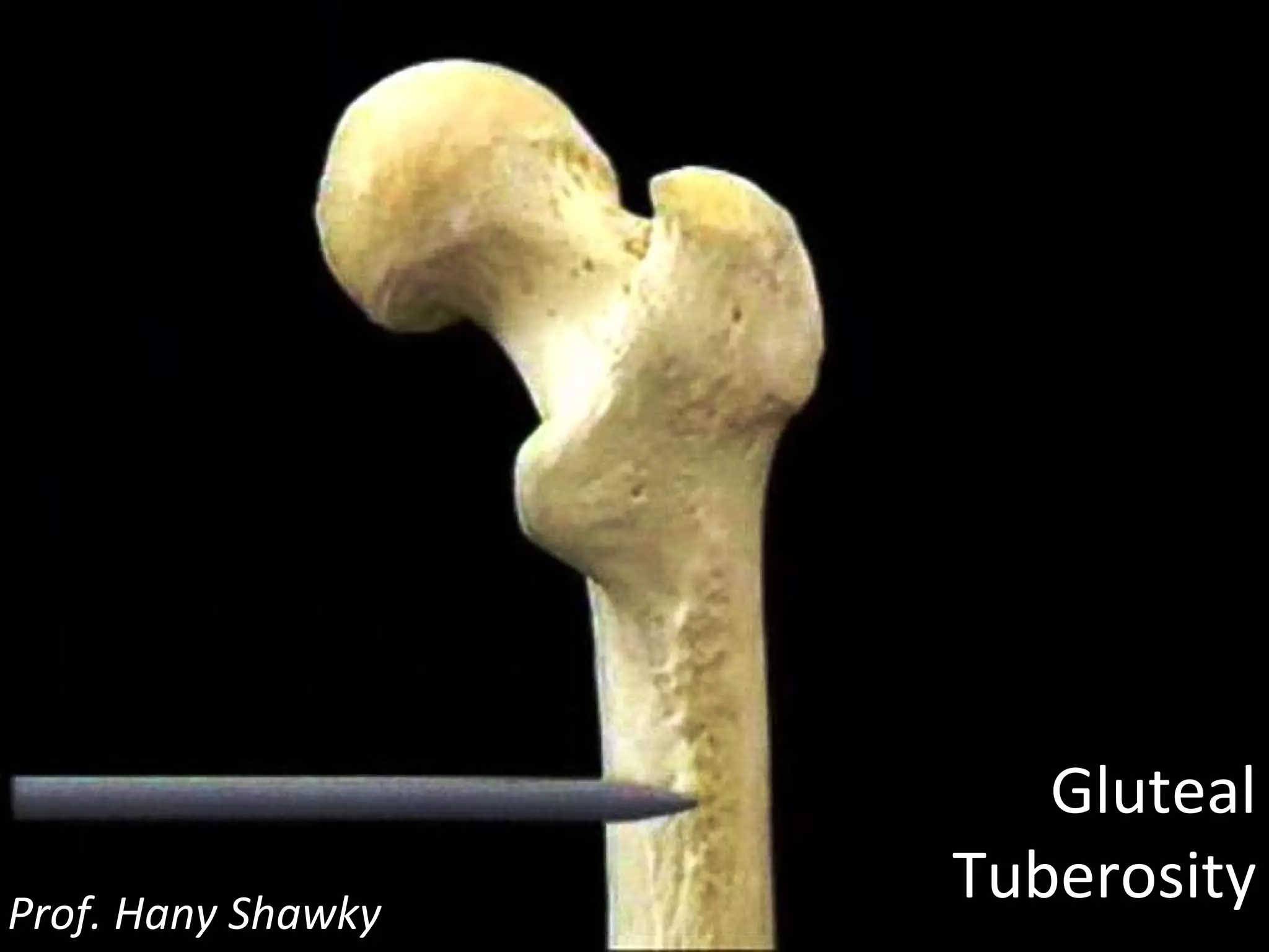 Gluteal Tuberosity Prof. Hany Shawky