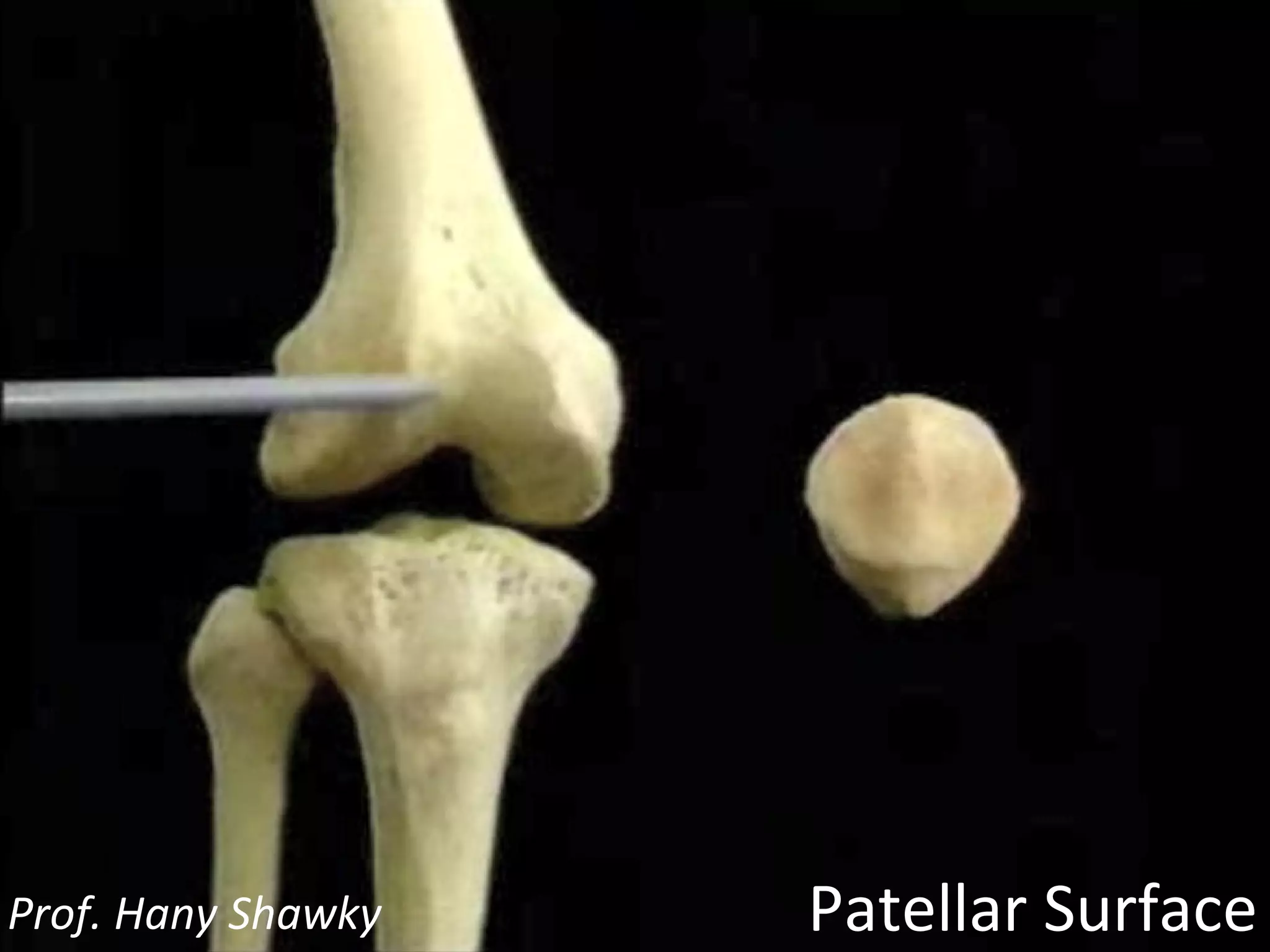 Patellar Surface Prof. Hany Shawky