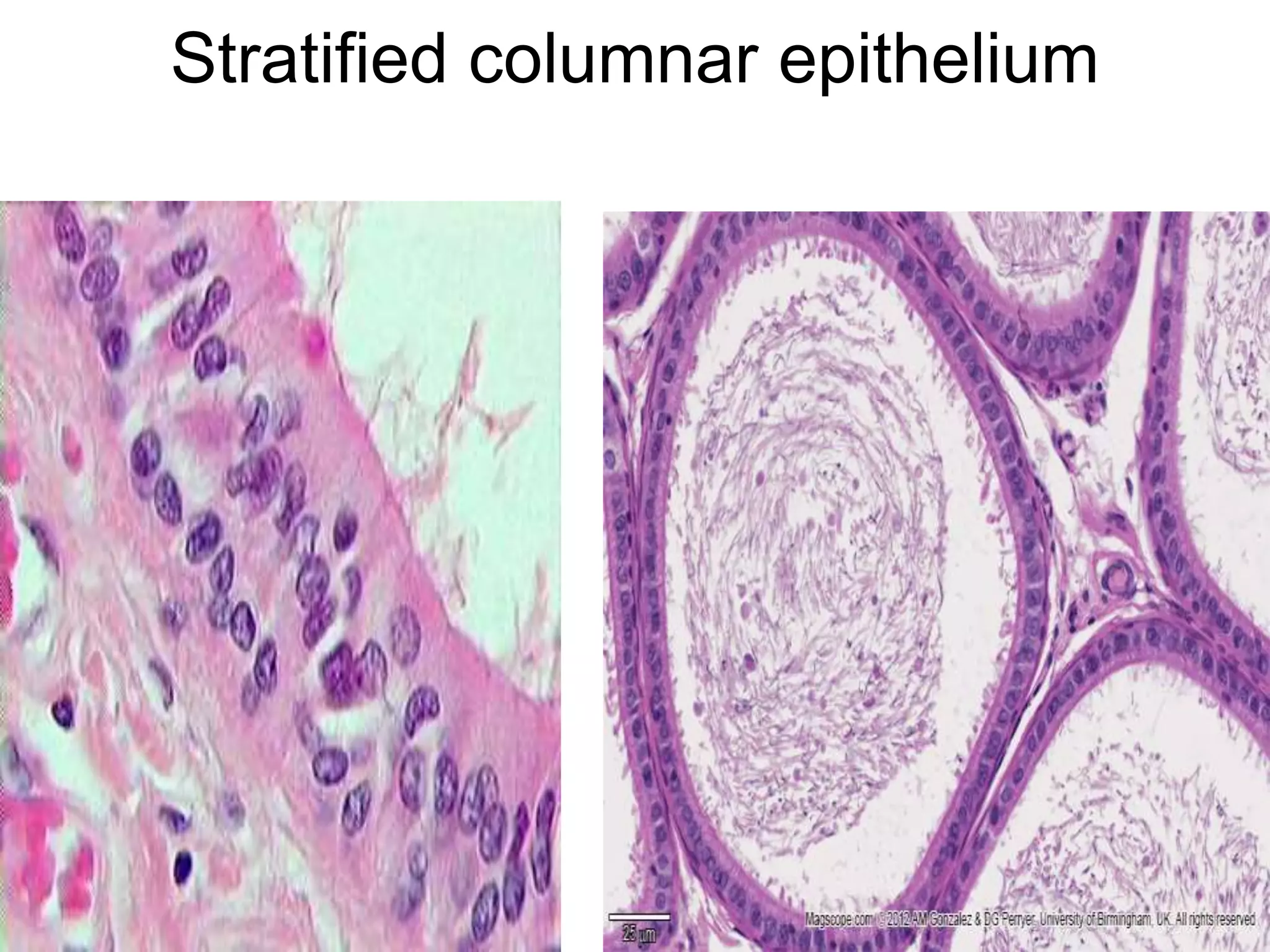 Stratified columnar epithelium
5/12/2016 10
 