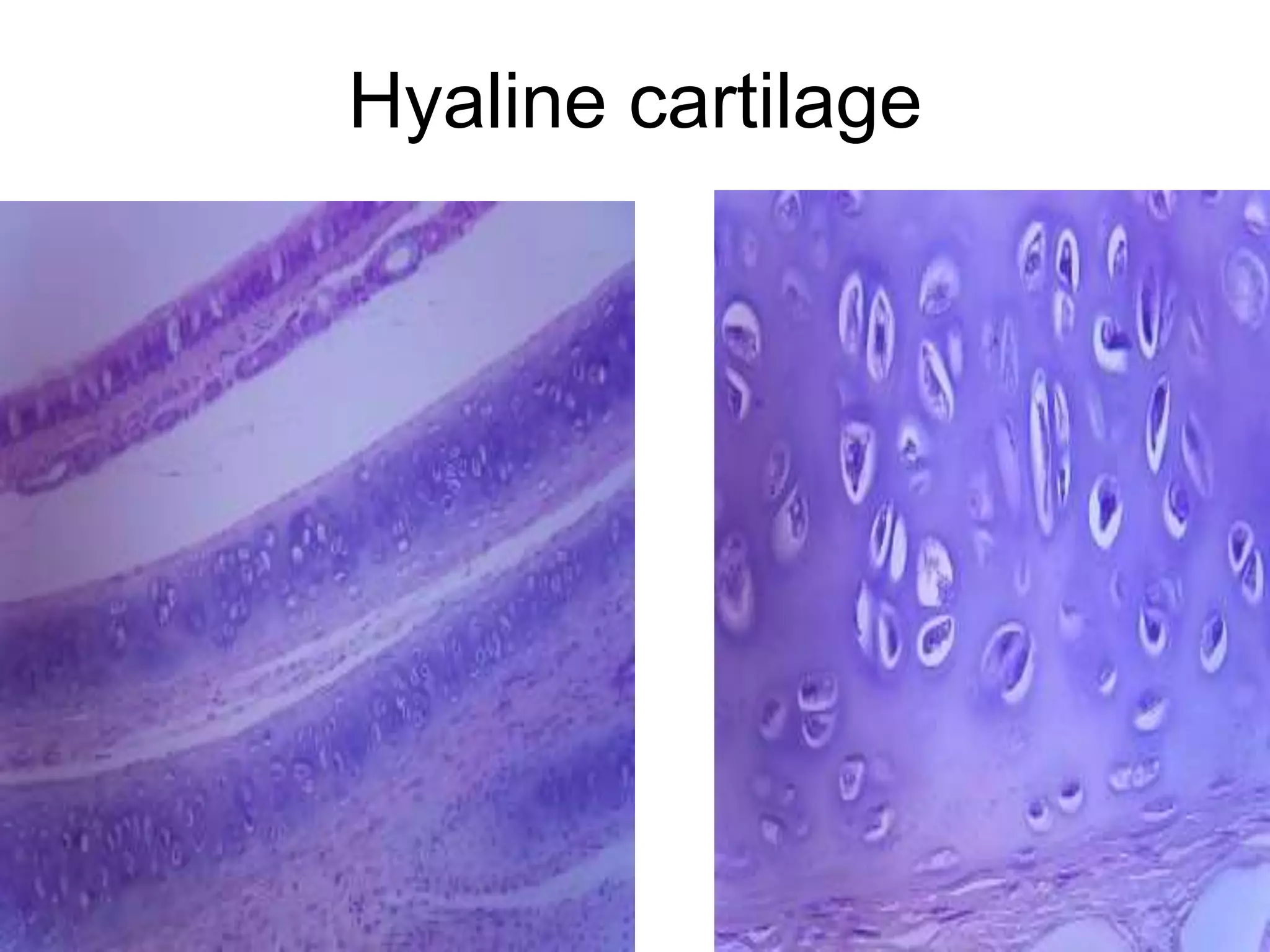 Hyaline cartilage
5/12/2016 13
 