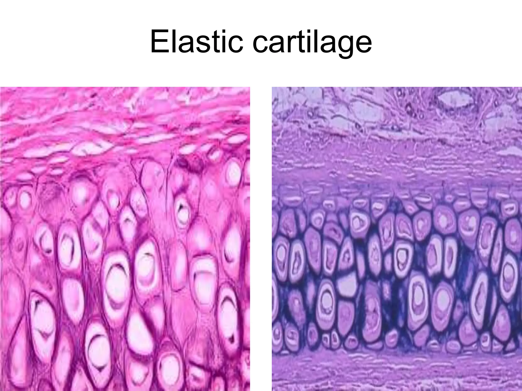 Elastic cartilage
5/12/2016 14
 