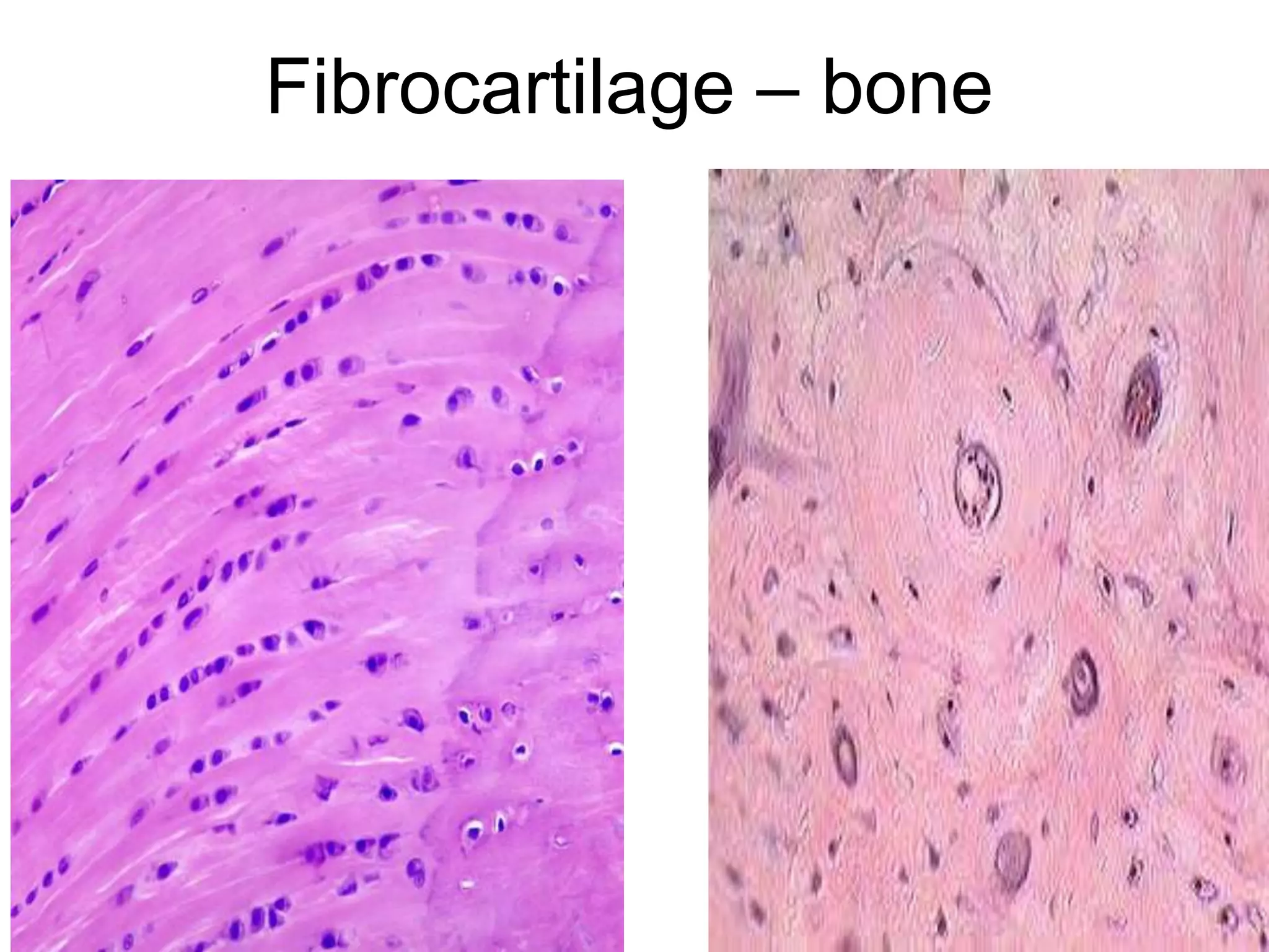 Fibrocartilage – bone
5/12/2016 15
 