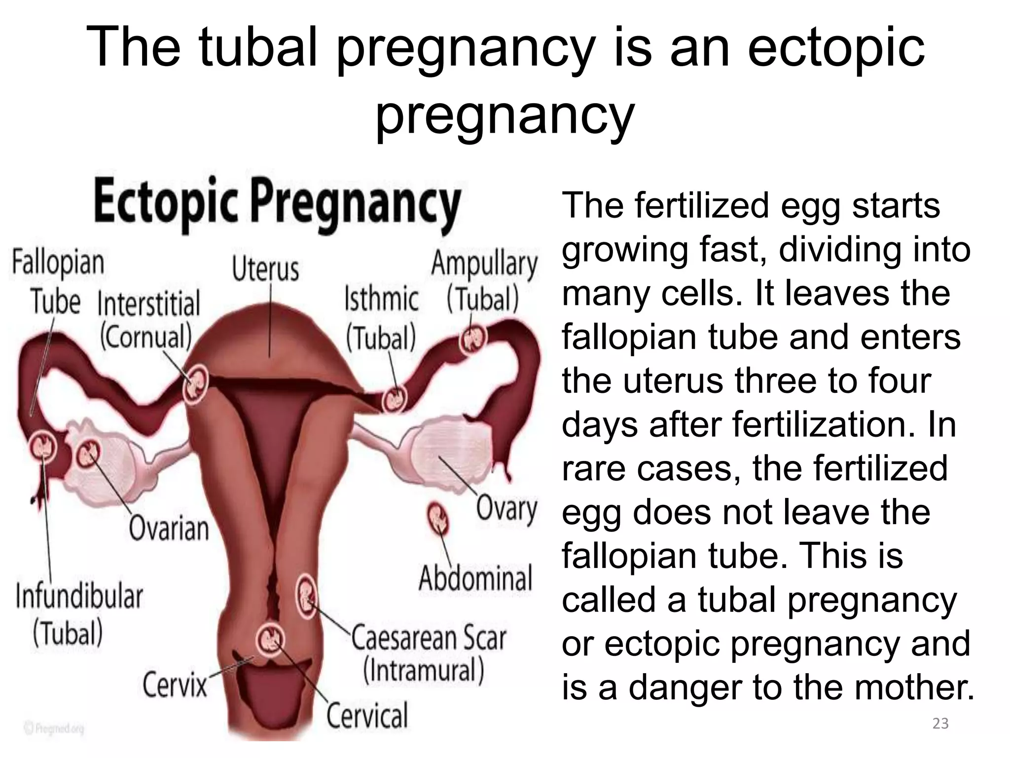 The tubal pregnancy is an ectopic
pregnancy
• The fertilized egg starts
growing fast, dividing into
many cells. It leaves the
fallopian tube and enters
the uterus three to four
days after fertilization. In
rare cases, the fertilized
egg does not leave the
fallopian tube. This is
called a tubal pregnancy
or ectopic pregnancy and
is a danger to the mother.
5/12/2016 23
 