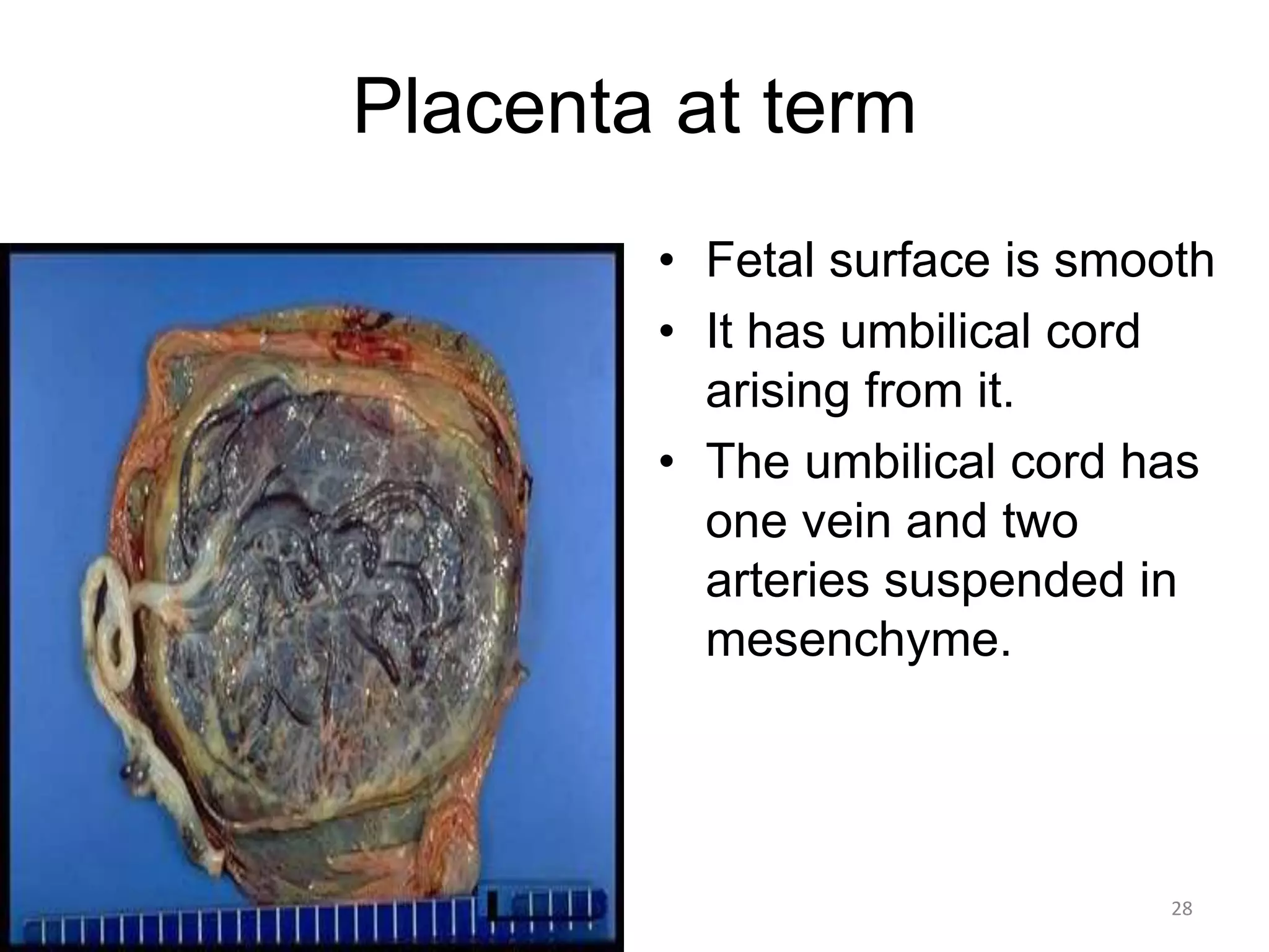 Placenta at term
• Fetal surface is smooth
• It has umbilical cord
arising from it.
• The umbilical cord has
one vein and two
arteries suspended in
mesenchyme.
5/12/2016 28
 