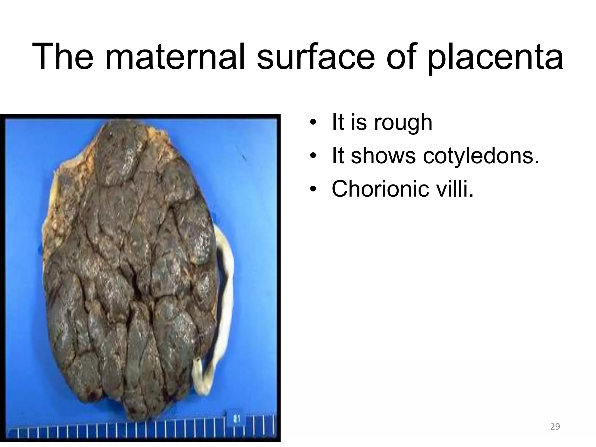The maternal surface of placenta
• It is rough
• It shows cotyledons.
• Chorionic villi.
5/12/2016 29
 