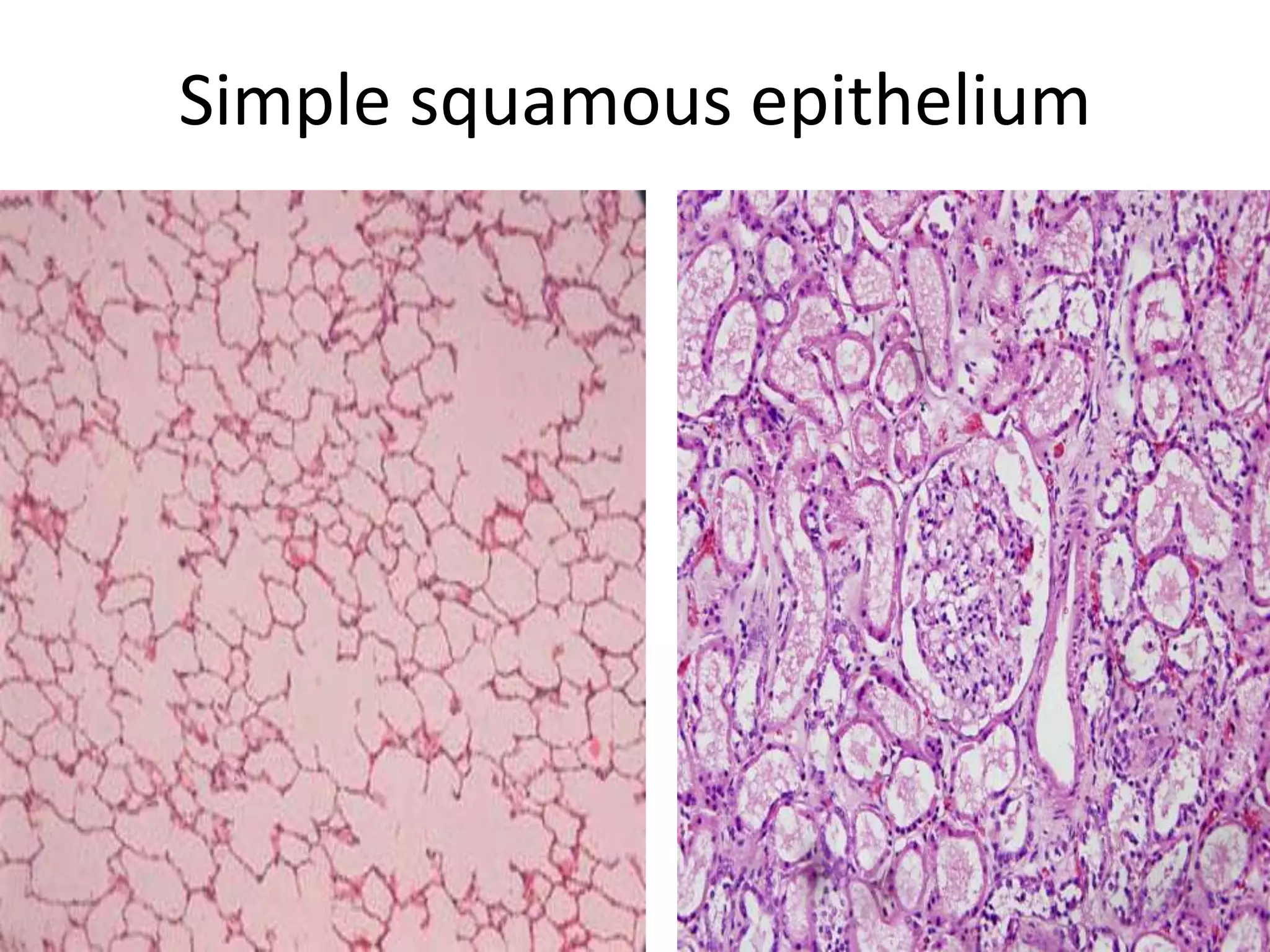 Simple squamous epithelium
5/12/2016 3
 