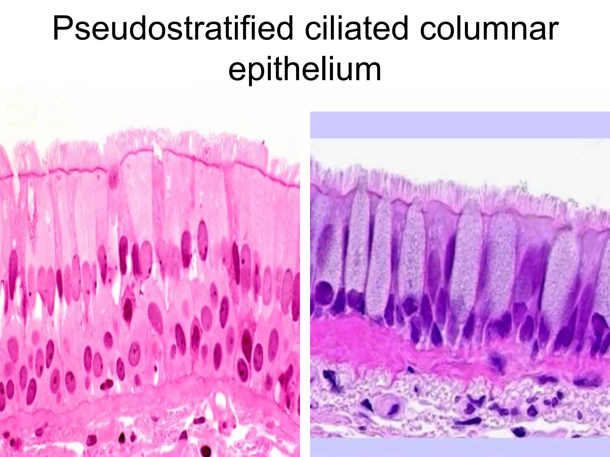 Pseudostratified ciliated columnar
epithelium
5/12/2016 6
 