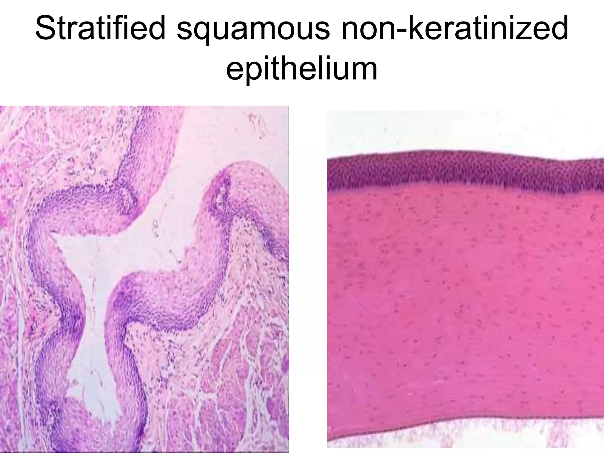 Stratified squamous non-keratinized
epithelium
5/12/2016 7
 