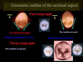 Geometric outline of the occlusal aspect
4

:Two cusp type

.It’s diamond-shaped
.Lingual convergence is sharp

:Three cusp type
The outline is square

5

The outline is oval
Slight lingual convergence

 