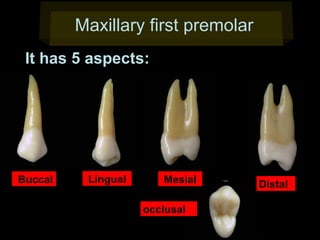 Maxillary first premolar
It has 5 aspects:

Buccal

Lingual

Mesial
occlusal

Distal

 