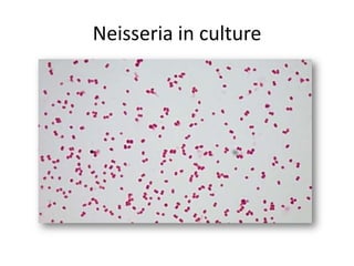 Neisseria in culture
 